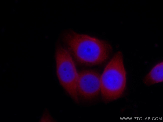 Follistatin Antibody in Immunocytochemistry (ICC/IF)