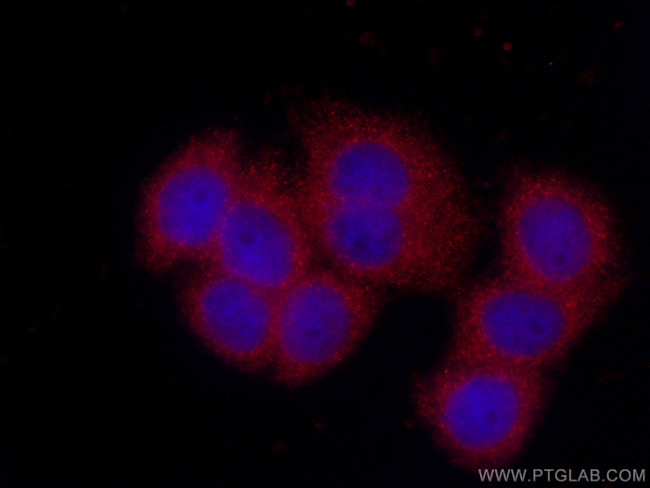 Stanniocalcin 2 Antibody in Immunocytochemistry (ICC/IF)