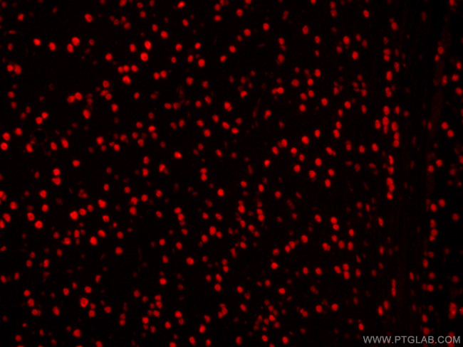 DACH1 Antibody in Immunohistochemistry (PFA fixed) (IHC (PFA))