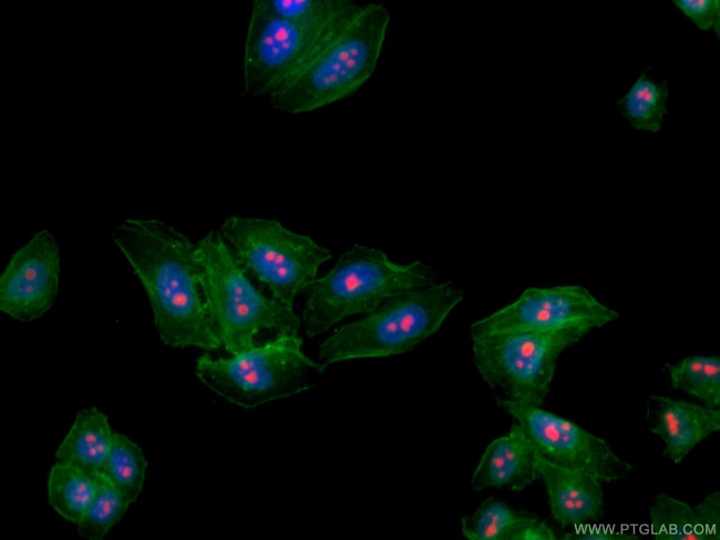 B23/NPM1 Antibody in Immunocytochemistry (ICC/IF)