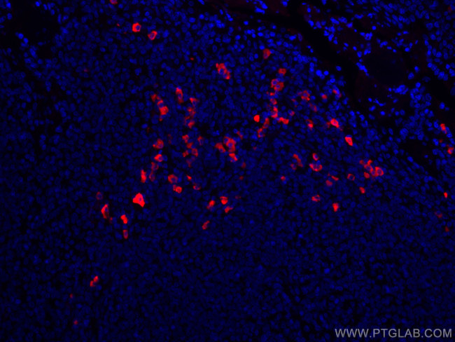 Human IgA Antibody in Immunohistochemistry (PFA fixed) (IHC (PFA))