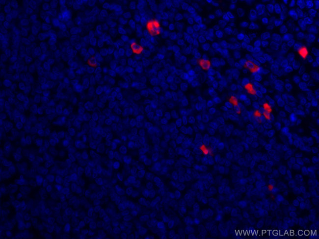 Human IgA Antibody in Immunohistochemistry (PFA fixed) (IHC (PFA))