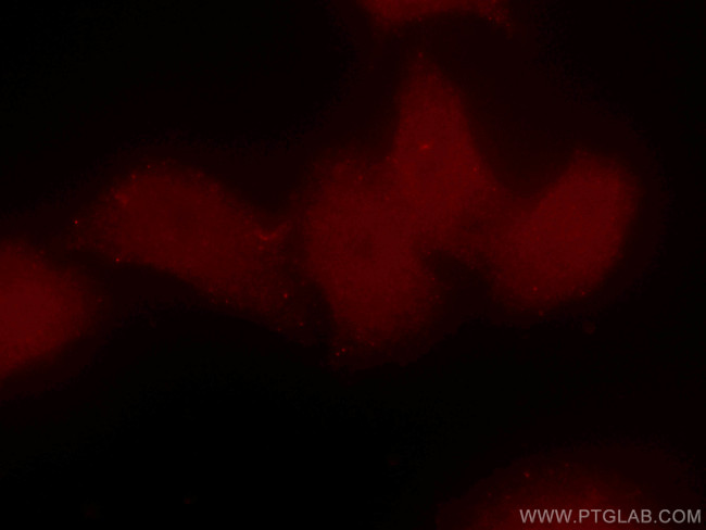 BRD8 Antibody in Immunocytochemistry (ICC/IF)