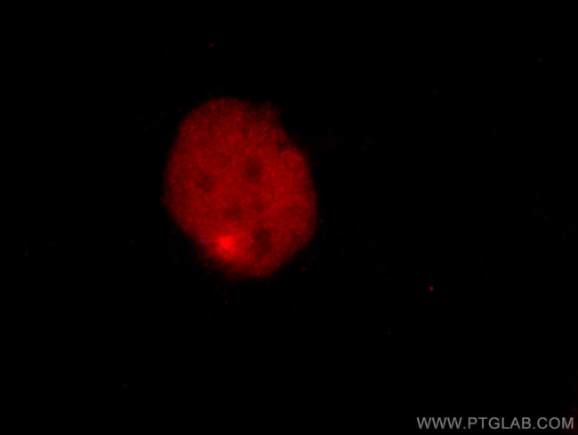 PAX8 Antibody in Immunocytochemistry (ICC/IF)