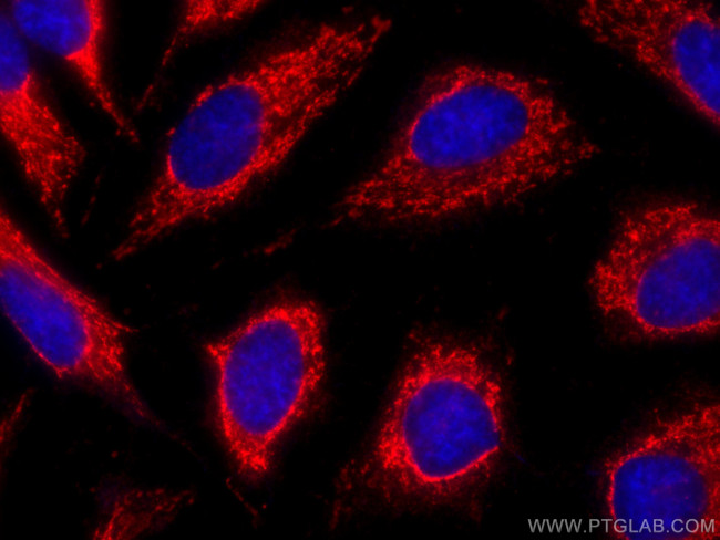 ALDH1A1 Antibody in Immunocytochemistry (ICC/IF)