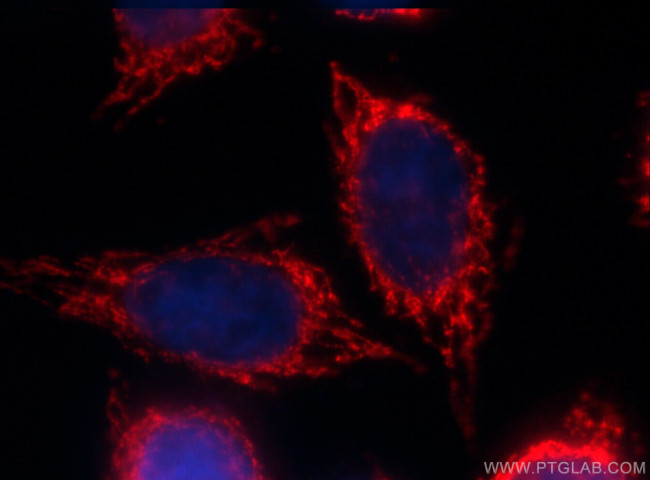 ALDH1A1 Antibody in Immunocytochemistry (ICC/IF)