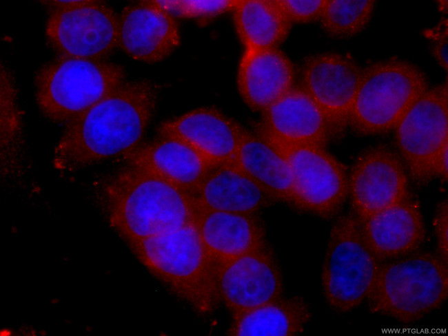 PCMT1 Antibody in Immunocytochemistry (ICC/IF)