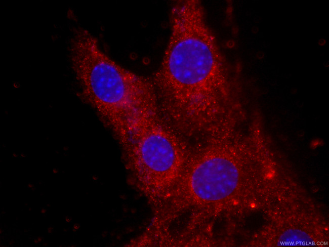 CKM-Specific Antibody in Immunocytochemistry (ICC/IF)