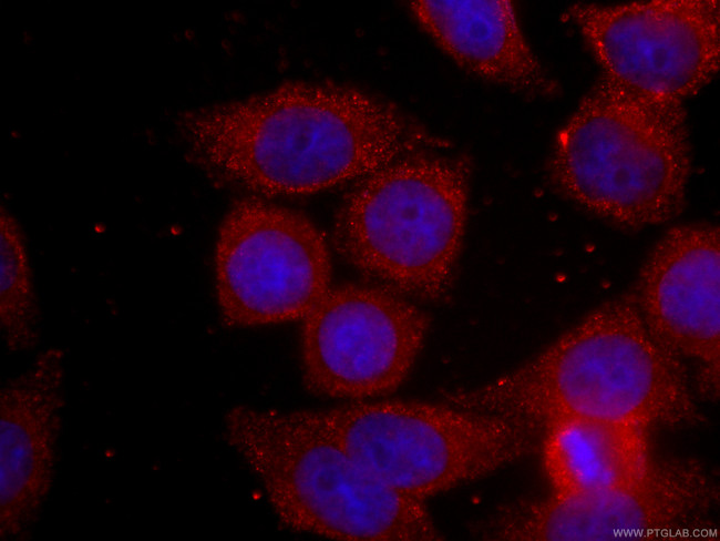 BCL2 Antibody in Immunocytochemistry (ICC/IF)