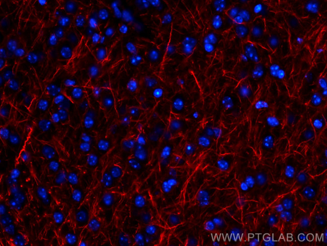 NF-L Antibody in Immunohistochemistry (PFA fixed) (IHC (PFA))