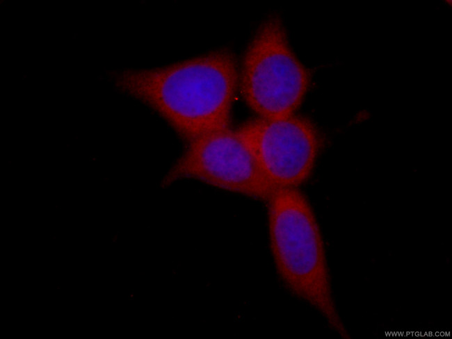 peroxiredoxin 2 Antibody in Immunocytochemistry (ICC/IF)