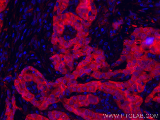 Galectin-3 Antibody in Immunohistochemistry (PFA fixed) (IHC (PFA))