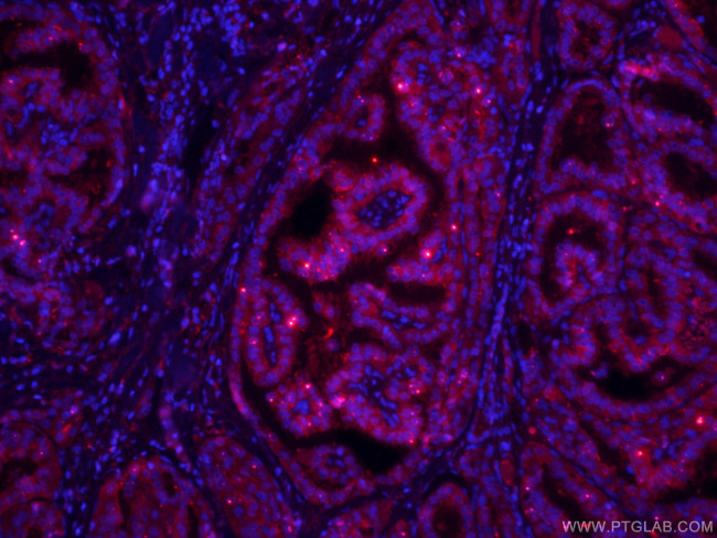 Galectin-3 Antibody in Immunohistochemistry (PFA fixed) (IHC (PFA))