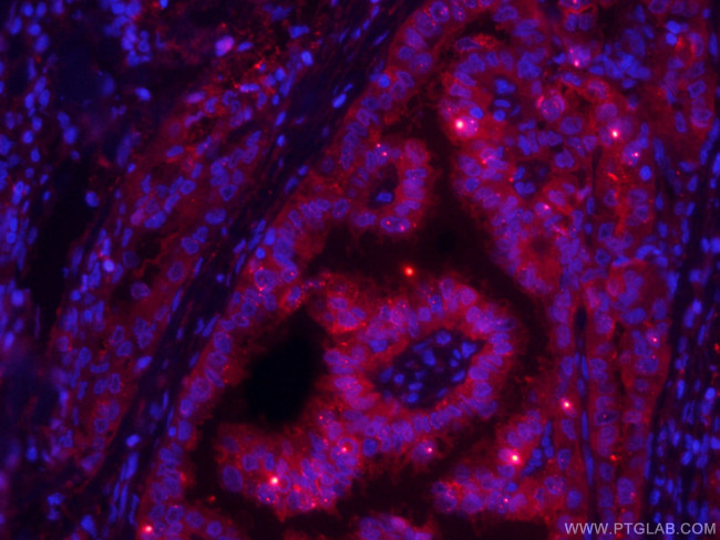 Galectin-3 Antibody in Immunohistochemistry (PFA fixed) (IHC (PFA))