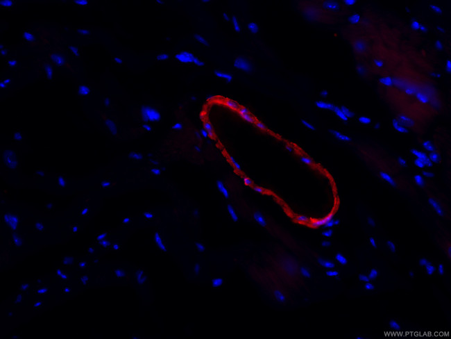 transgelin/SM22 Antibody in Immunohistochemistry (PFA fixed) (IHC (PFA))