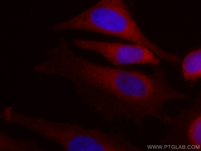 IL1R2 Antibody in Immunocytochemistry (ICC/IF)