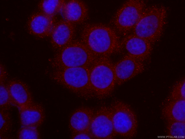 IL1R2 Antibody in Immunocytochemistry (ICC/IF)