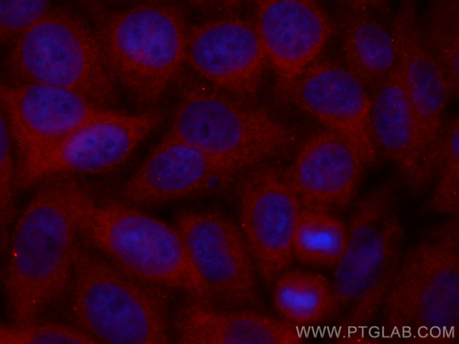 CCT3 Antibody in Immunocytochemistry (ICC/IF)