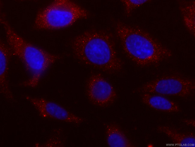 PKM2-specific Antibody in Immunocytochemistry (ICC/IF)