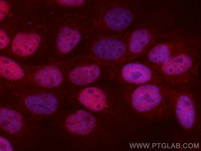 P53 Antibody in Immunocytochemistry (ICC/IF)