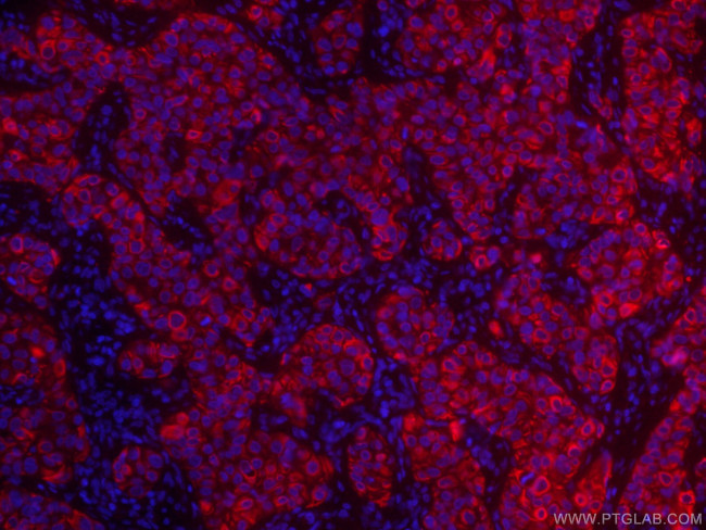 TNF alpha Antibody in Immunohistochemistry (PFA fixed) (IHC (PFA))