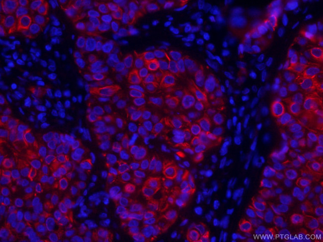 TNF alpha Antibody in Immunohistochemistry (PFA fixed) (IHC (PFA))