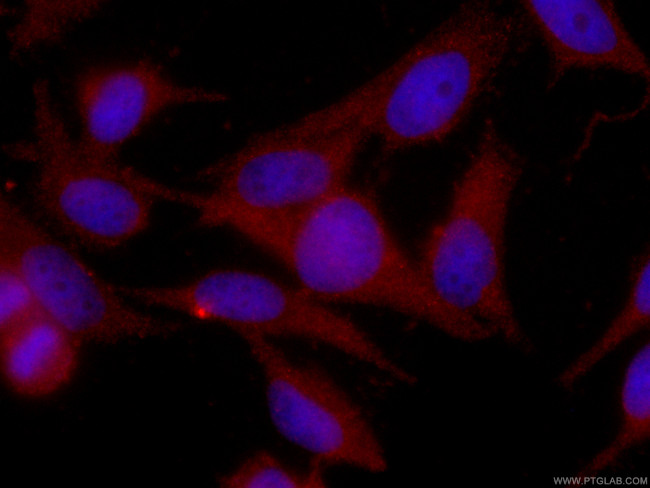 SGTA Antibody in Immunocytochemistry (ICC/IF)