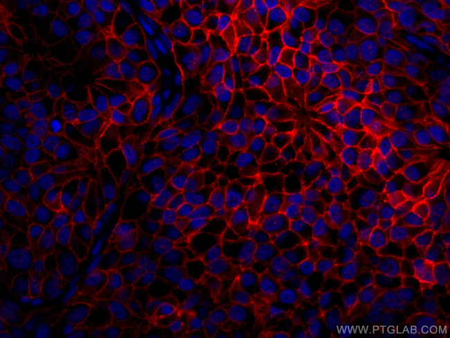 HER2/ErbB2 Antibody in Immunohistochemistry (PFA fixed) (IHC (PFA))