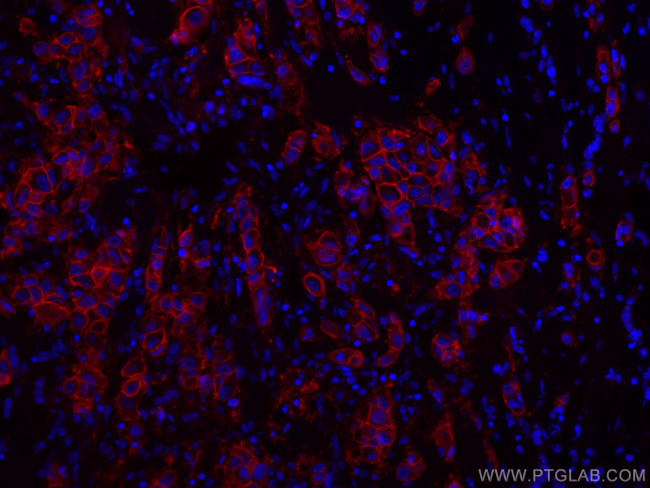 HER2/ErbB2 Antibody in Immunohistochemistry (PFA fixed) (IHC (PFA))