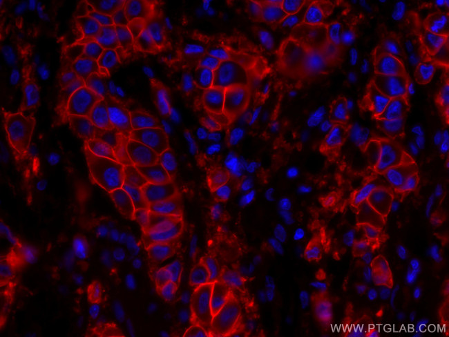 HER2/ErbB2 Antibody in Immunohistochemistry (PFA fixed) (IHC (PFA))