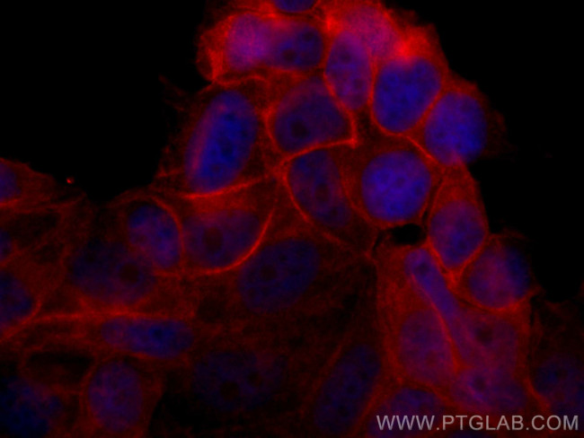 c-SRC Antibody in Immunocytochemistry (ICC/IF)