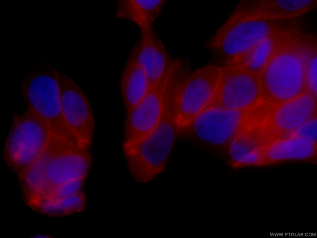 c-SRC Antibody in Immunocytochemistry (ICC/IF)