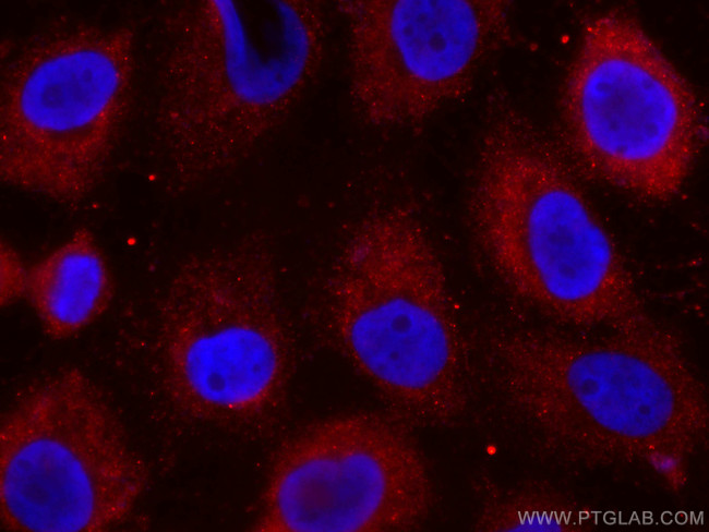 Cytokeratin 14 Antibody in Immunocytochemistry (ICC/IF)