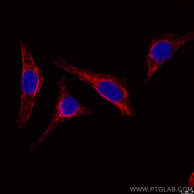 Vimentin Antibody in Immunocytochemistry (ICC/IF)