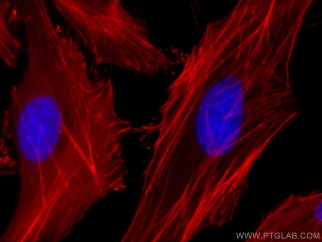 beta Actin Antibody in Immunocytochemistry (ICC/IF)