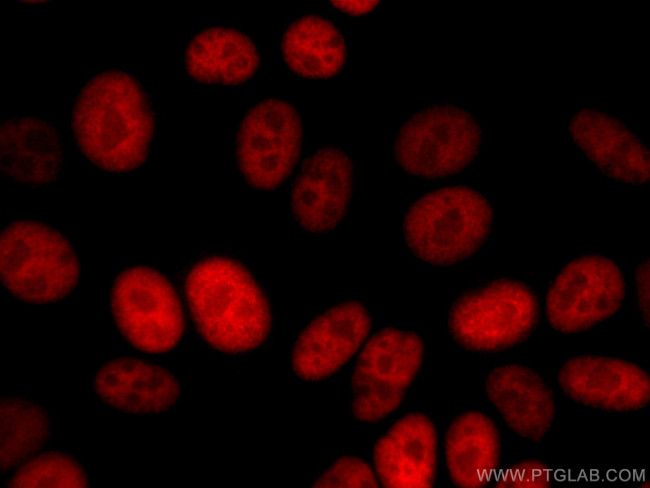 Transketolase Antibody in Immunocytochemistry (ICC/IF)