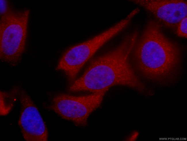 TPPII Antibody in Immunocytochemistry (ICC/IF)