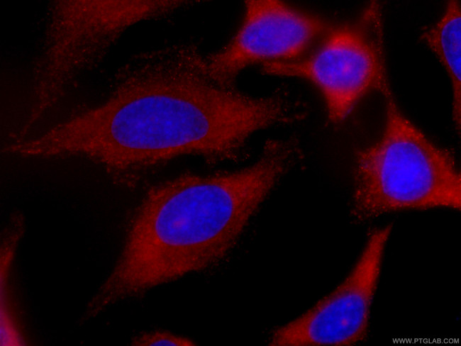 EIF3D Antibody in Immunocytochemistry (ICC/IF)