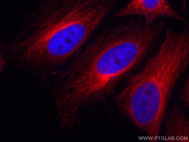 alpha Tubulin Antibody in Immunocytochemistry (ICC/IF)