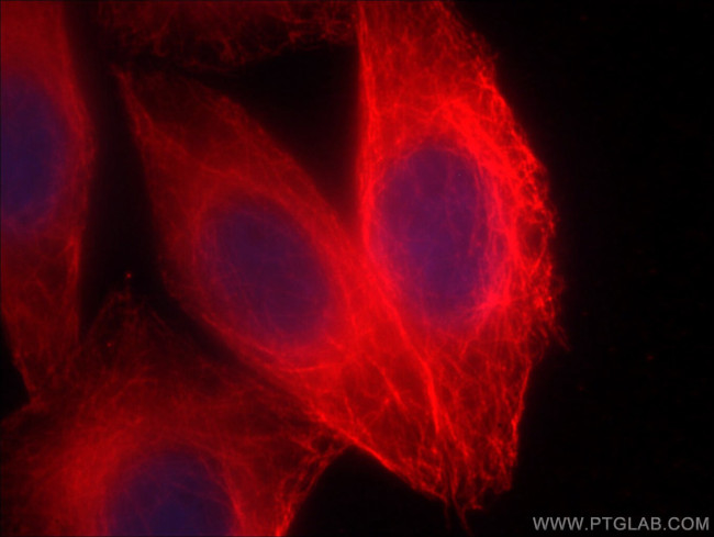 alpha Tubulin Antibody in Immunocytochemistry (ICC/IF)