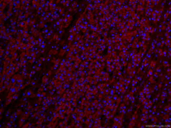 IVD Antibody in Immunohistochemistry (PFA fixed) (IHC (PFA))