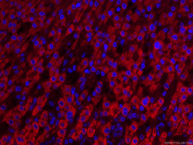 IVD Antibody in Immunohistochemistry (PFA fixed) (IHC (PFA))