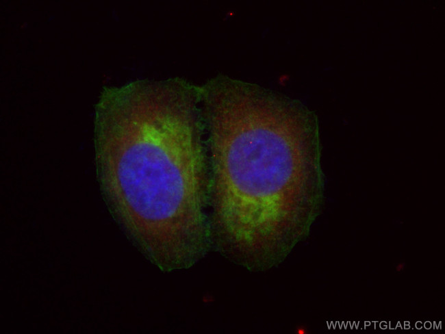 ASS1 Antibody in Immunocytochemistry (ICC/IF)