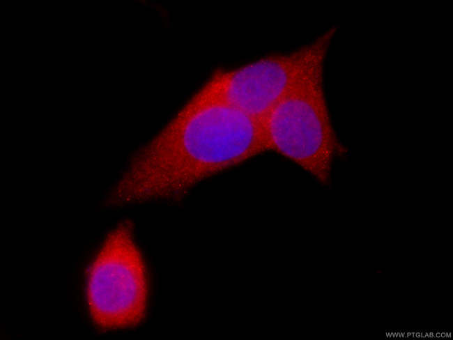 ASS1 Antibody in Immunocytochemistry (ICC/IF)