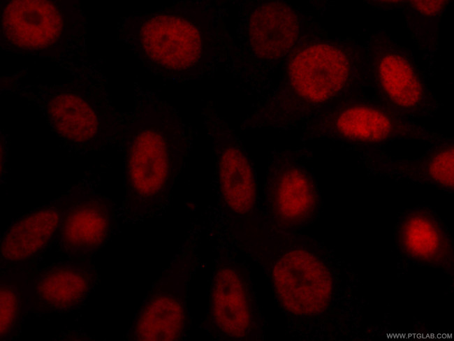 CUL4A Antibody in Immunocytochemistry (ICC/IF)