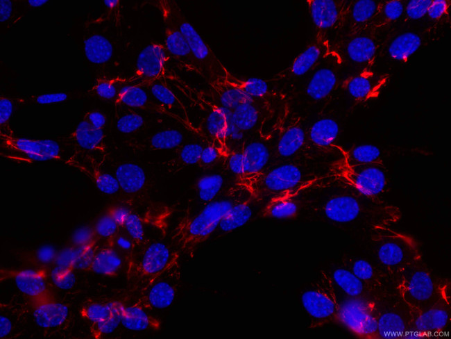 Fibronectin Antibody in Immunocytochemistry (ICC/IF)