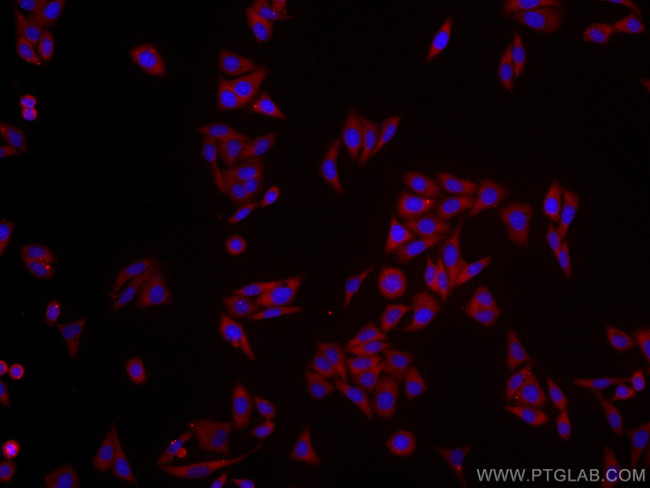 RPS3 Antibody in Immunocytochemistry (ICC/IF)