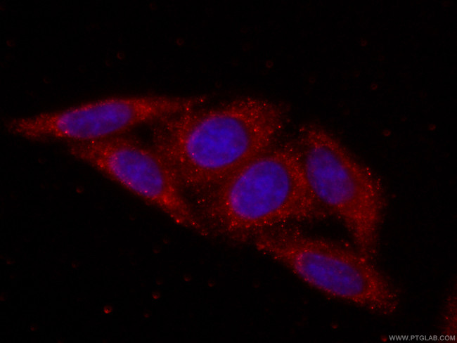 RPS3 Antibody in Immunocytochemistry (ICC/IF)