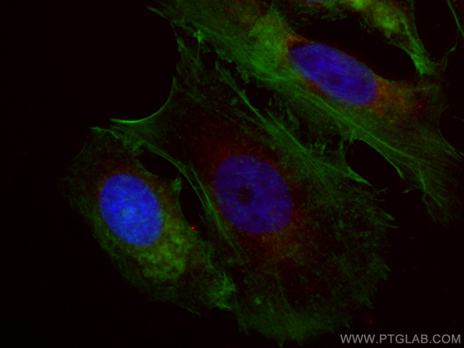 NDUFA4L2 Antibody in Immunocytochemistry (ICC/IF)