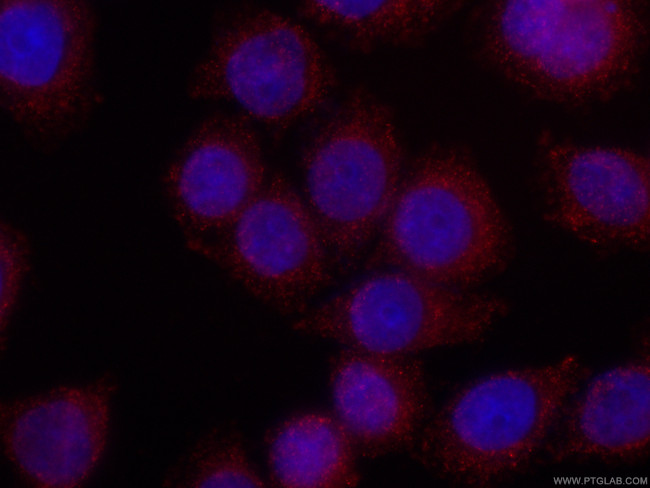 RAB27A Antibody in Immunocytochemistry (ICC/IF)